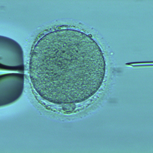 Intra-cytoplasmic Sperm Injection